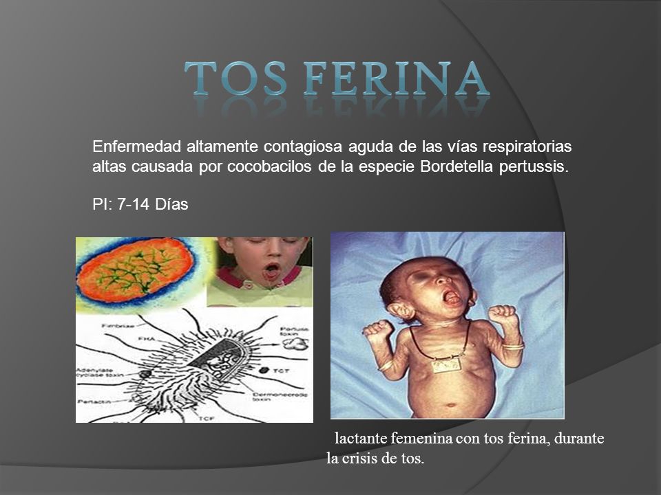 TOS FERINA Enfermedad altamente contagiosa aguda de las vías respiratorias altas causada por cocobacilos de la especie Bordetella pertussis.