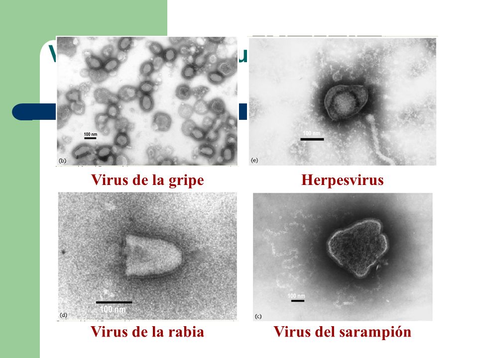 Virus con envoltura Virus de la gripe Herpesvirus Virus de la rabia