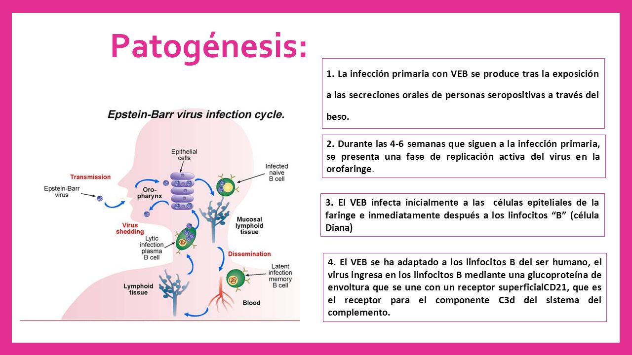 Patogénesis: 1. La infección primaria con VEB se produce tras la exposición a las secreciones orales de personas seropositivas a través del beso.