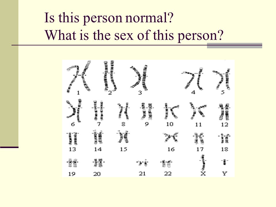 Is this person normal What is the sex of this person