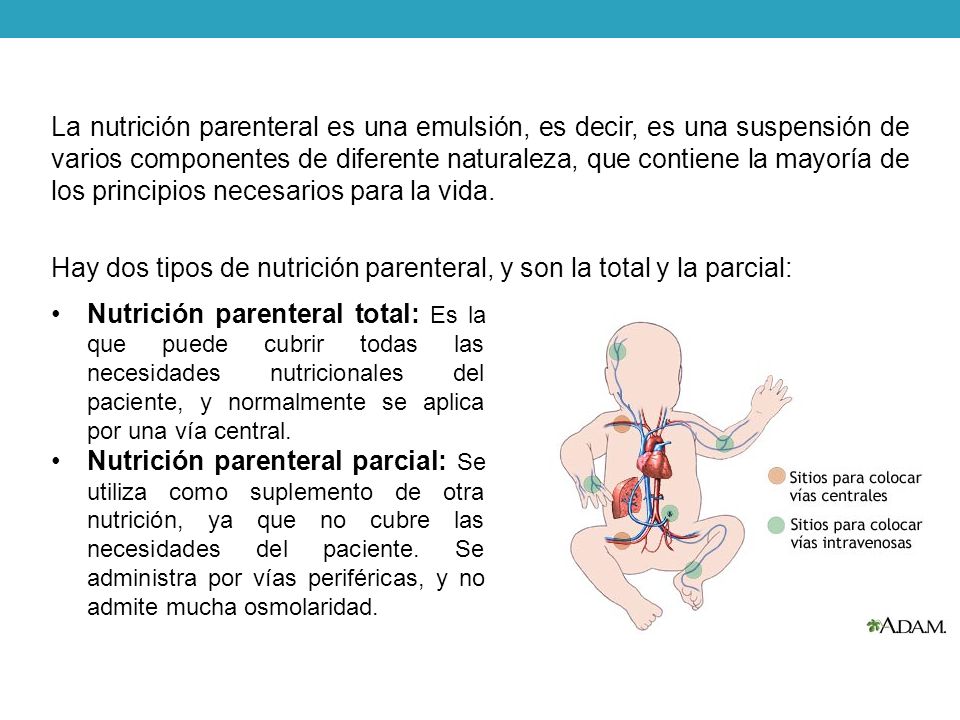 La nutrición parenteral es una emulsión, es decir, es una suspensión de varios componentes de diferente naturaleza, que contiene la mayoría de los principios necesarios para la vida. Hay dos tipos de nutrición parenteral, y son la total y la parcial: