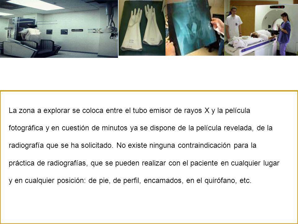 La zona a explorar se coloca entre el tubo emisor de rayos X y la película fotográfica y en cuestión de minutos ya se dispone de la película revelada, de la radiografía que se ha solicitado.