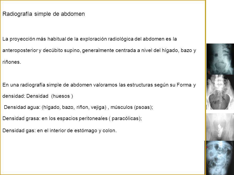 Radiografía simple de abdomen La proyección más habitual de la exploración radiológica del abdomen es la anteroposterior y decúbito supino, generalmente centrada a nivel del hígado, bazo y riñones.