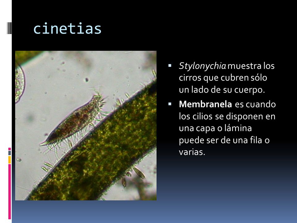 cinetias Stylonychia muestra los cirros que cubren sólo un lado de su cuerpo.
