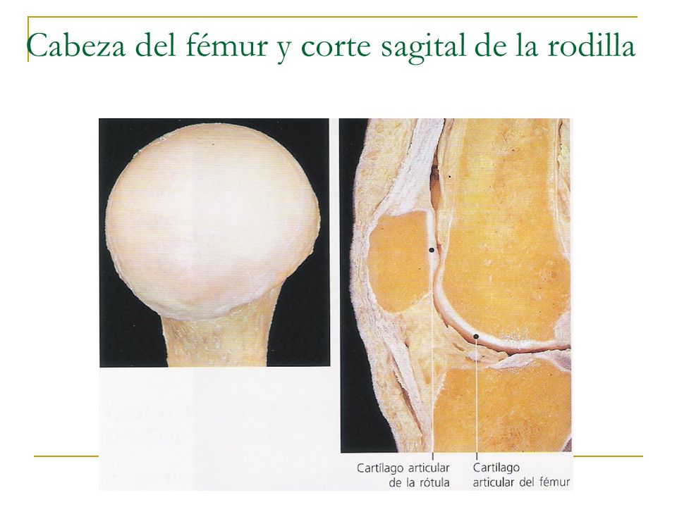 Cabeza del fémur y corte sagital de la rodilla