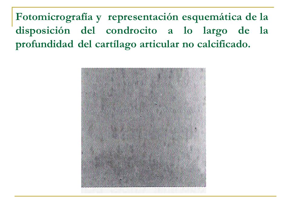 Fotomicrografía y representación esquemática de la disposición del condrocito a lo largo de la profundidad del cartílago articular no calcificado.