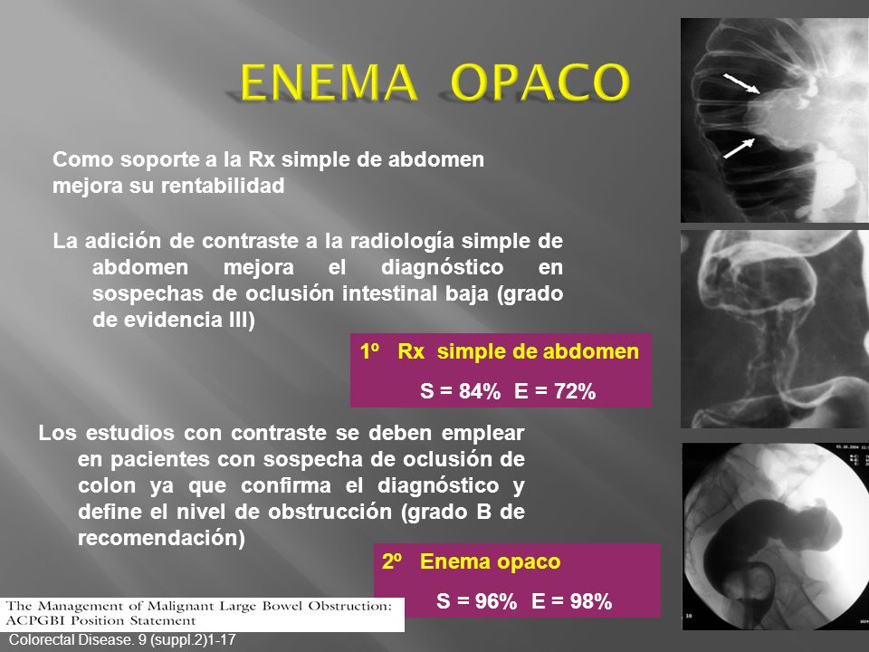 ENEMA OPACO Como soporte a la Rx simple de abdomen
