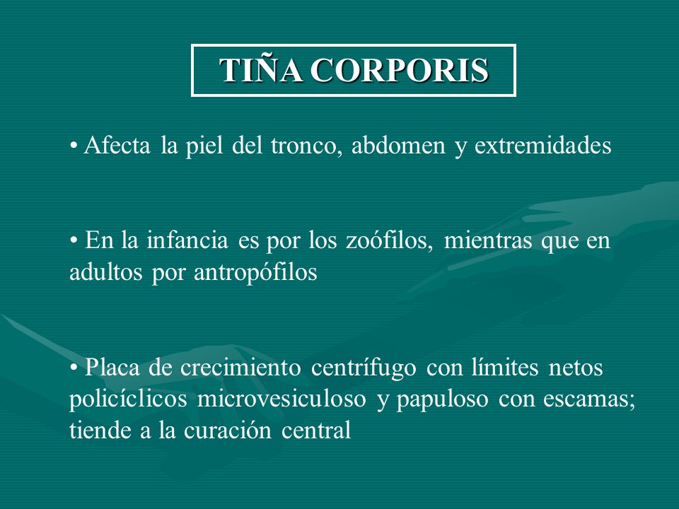 TIÑA CORPORIS Afecta la piel del tronco, abdomen y extremidades