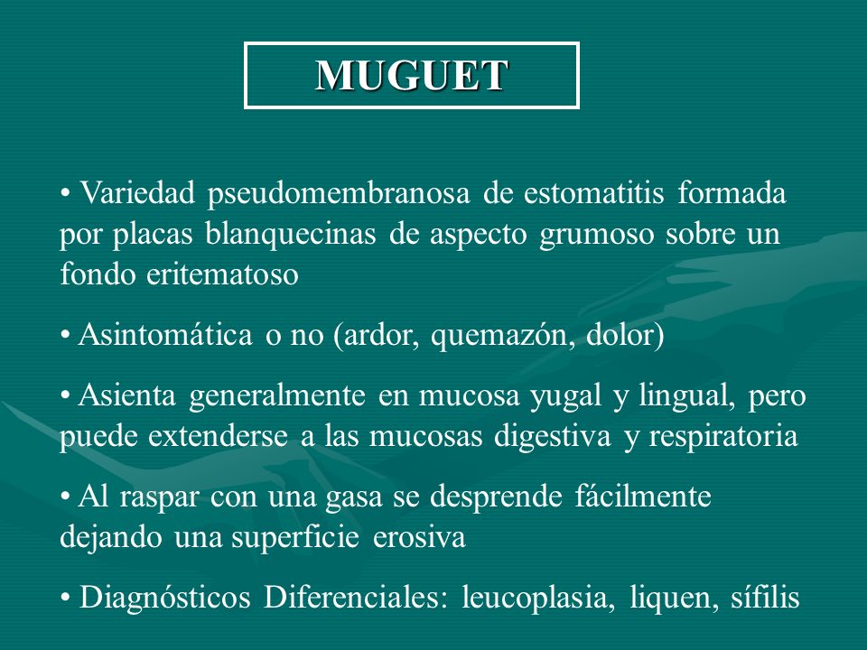 MUGUET Variedad pseudomembranosa de estomatitis formada por placas blanquecinas de aspecto grumoso sobre un fondo eritematoso.