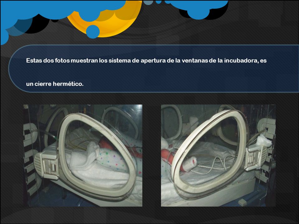 Estas dos fotos muestran los sistema de apertura de la ventanas de la incubadora, es un cierre hermético.