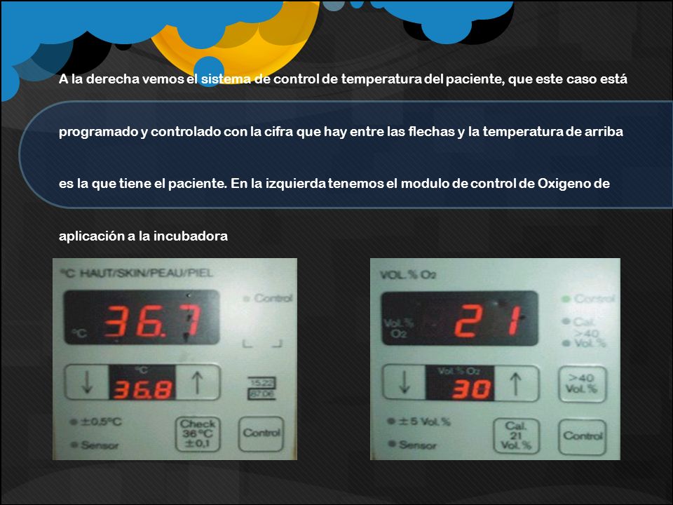 A la derecha vemos el sistema de control de temperatura del paciente, que este caso está programado y controlado con la cifra que hay entre las flechas y la temperatura de arriba es la que tiene el paciente.