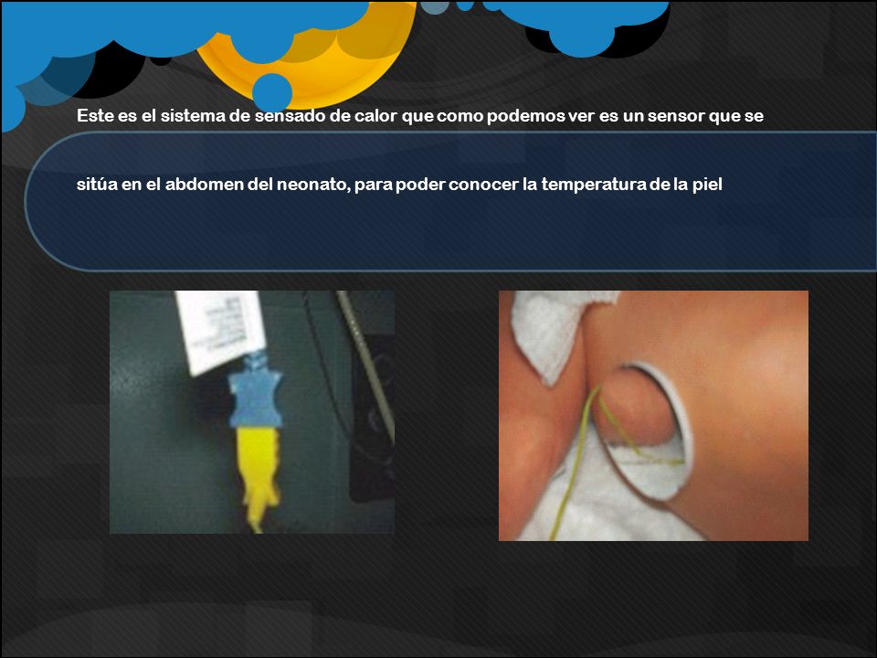 Este es el sistema de sensado de calor que como podemos ver es un sensor que se sitúa en el abdomen del neonato, para poder conocer la temperatura de la piel
