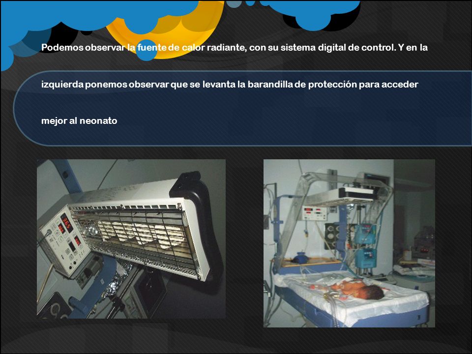 Podemos observar la fuente de calor radiante, con su sistema digital de control.