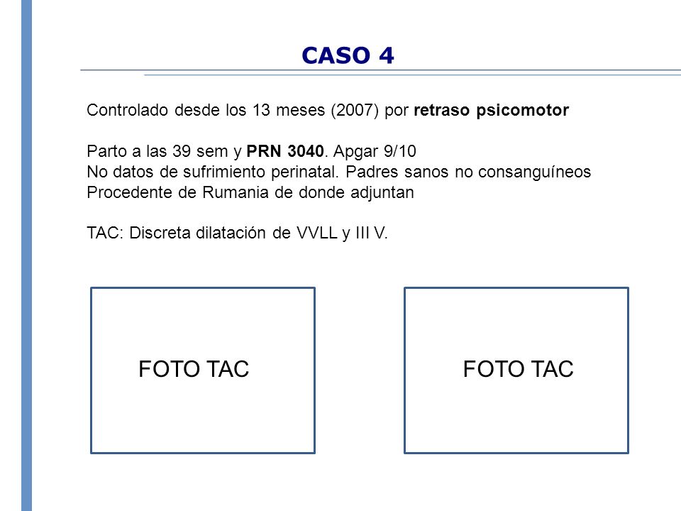 CASO 4 Controlado desde los 13 meses (2007) por retraso psicomotor. Parto a las 39 sem y PRN Apgar 9/10.