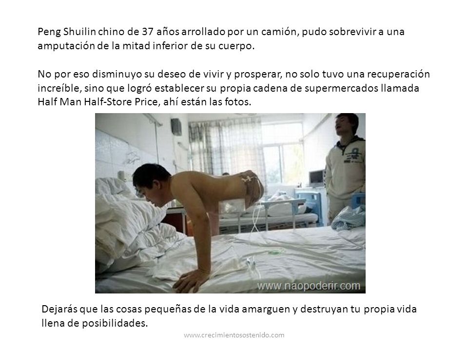Peng Shuilin chino de 37 años arrollado por un camión, pudo sobrevivir a una amputación de la mitad inferior de su cuerpo.