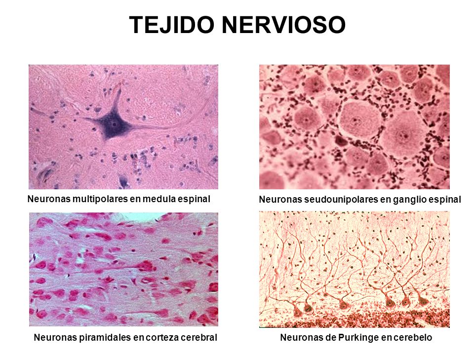 TEJIDO NERVIOSO Neuronas multipolares en medula espinal