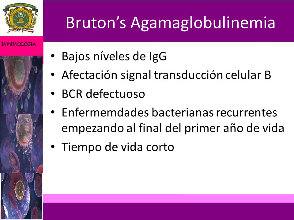 Bruton’s Agamaglobulinemia