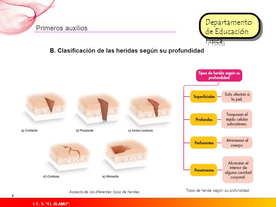 C. Actuaciones Cuando nos encontremos ante una herida nuestra actuación debe estar encaminada a tratar la hemorragia y prevenir las infecciones,