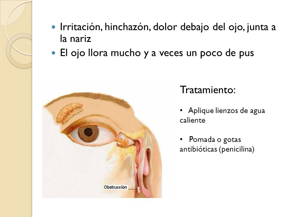 Irritación, hinchazón, dolor debajo del ojo, junta a la nariz