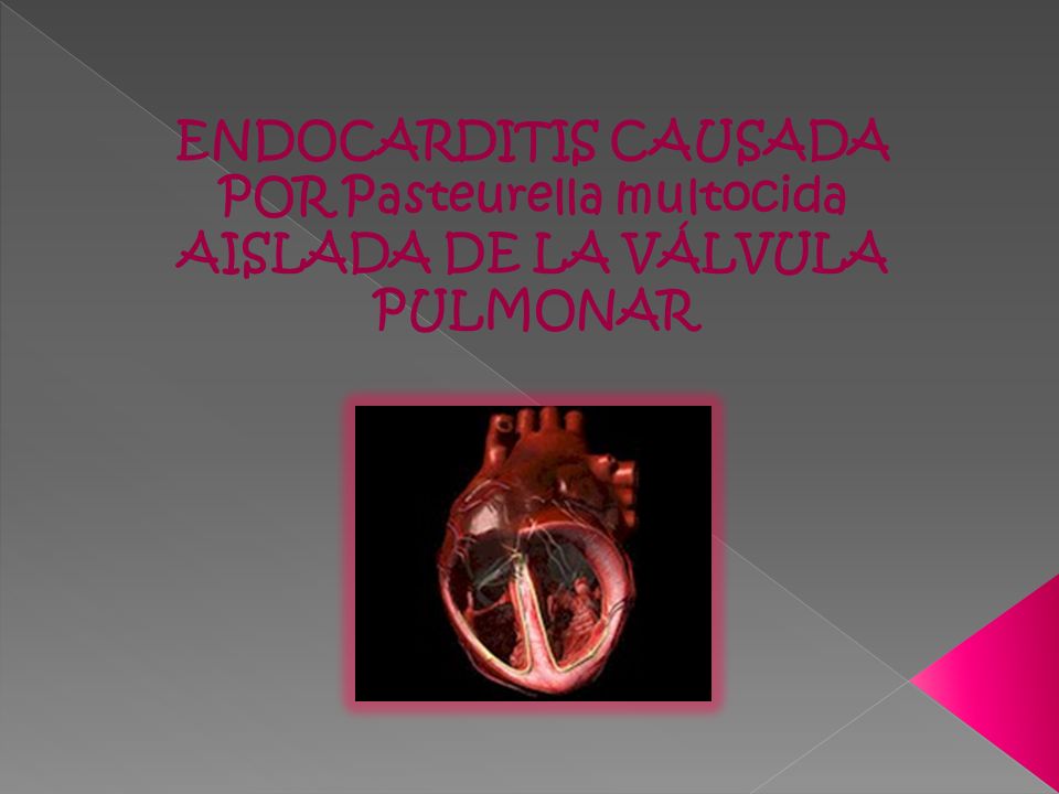 ENDOCARDITIS CAUSADA POR Pasteurella multocida AISLADA DE LA VÁLVULA PULMONAR