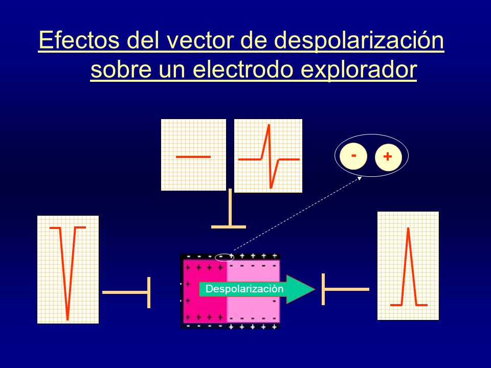 Efectos del vector de despolarización sobre un electrodo explorador