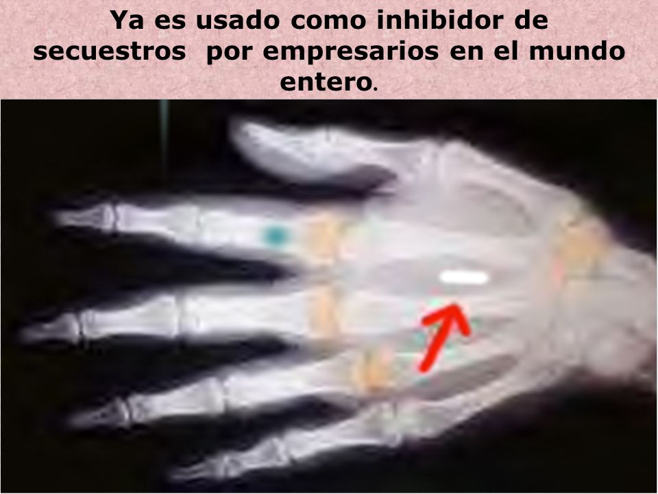 Ya es usado como inhibidor de secuestros por empresarios en el mundo entero.