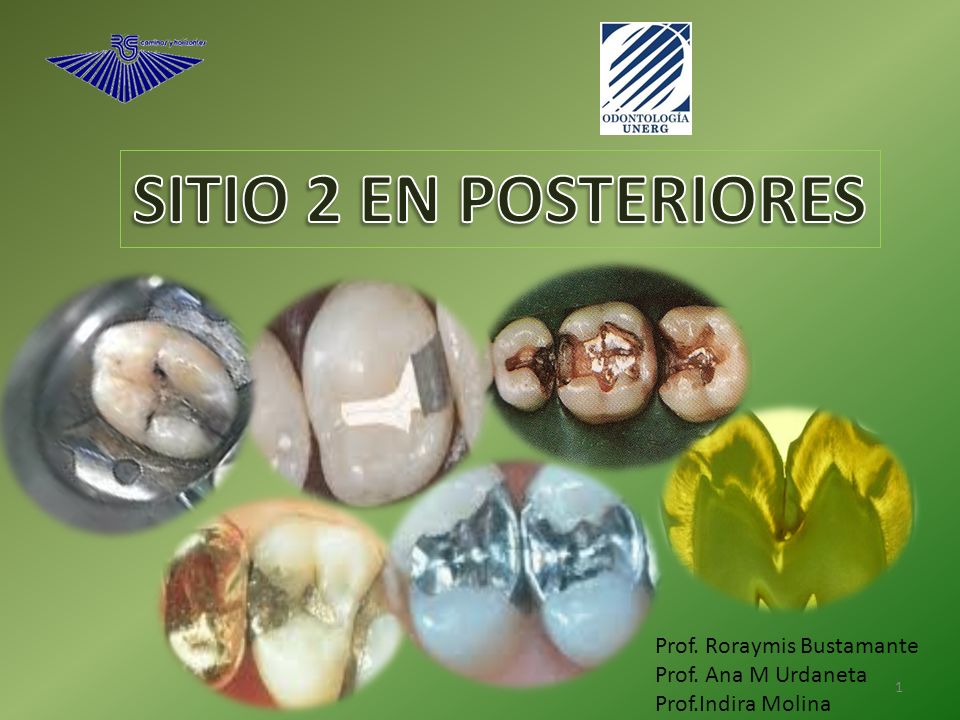 SITIO 2 EN POSTERIORES Prof. Roraymis Bustamante Prof. Ana M Urdaneta