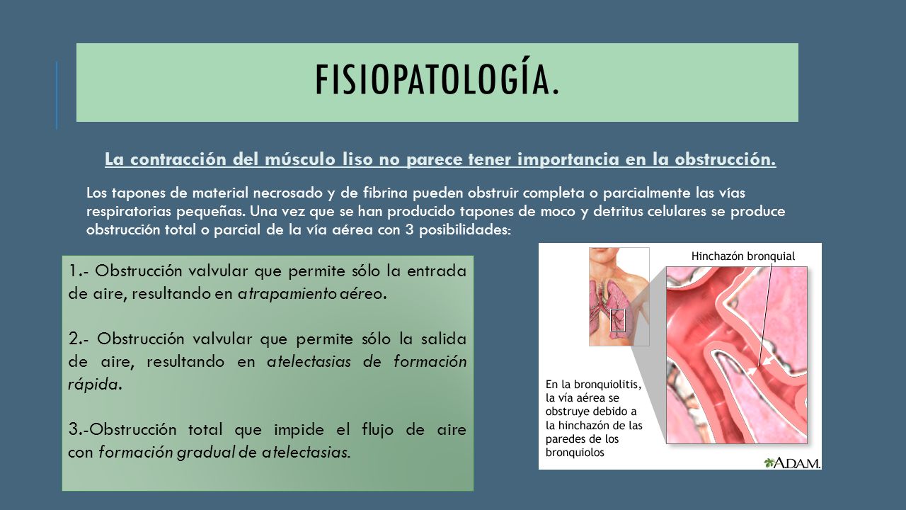 FISIOPATOLOGÍA. La contracción del músculo liso no parece tener importancia en la obstrucción.