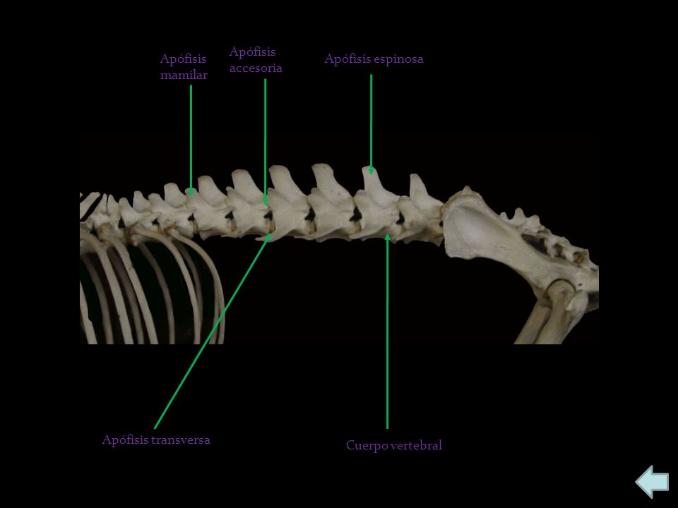 Apófisis accesoria Apófisis mamilar Apófisis espinosa Apófisis transversa Cuerpo vertebral
