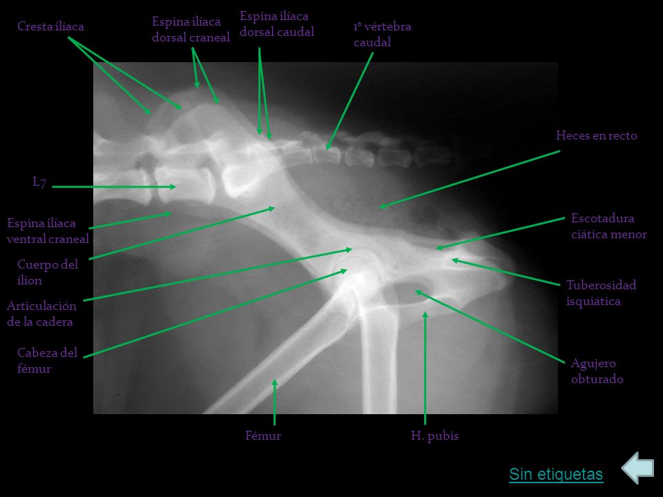 Sin etiquetas Espina ilíaca dorsal caudal Espina ilíaca dorsal craneal