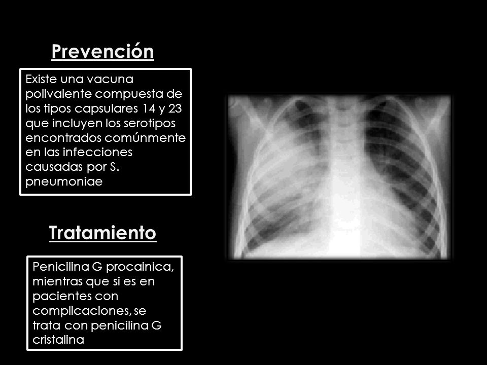 Prevención Tratamiento
