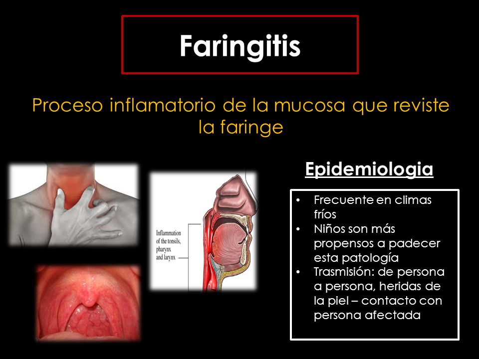 Proceso inflamatorio de la mucosa que reviste la faringe
