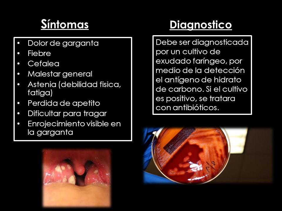 Síntomas Diagnostico. Dolor de garganta. Fiebre. Cefalea. Malestar general. Astenia (debilidad fisica, fatiga)