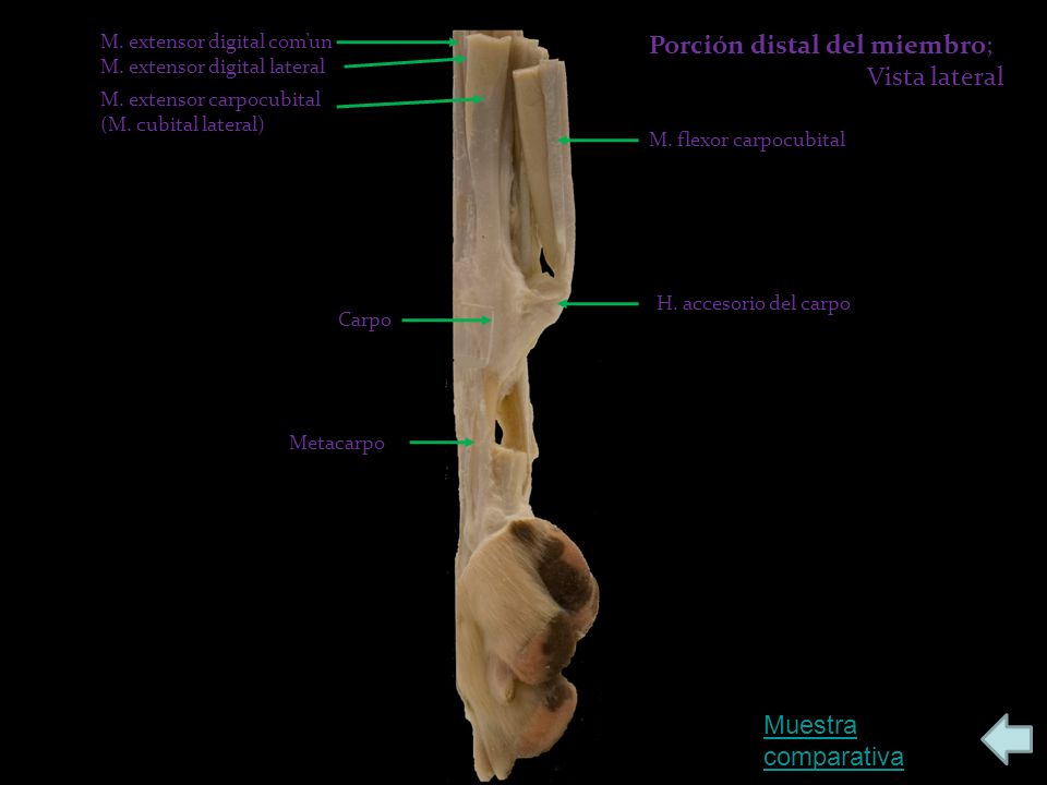 Porción distal del miembro; Vista lateral