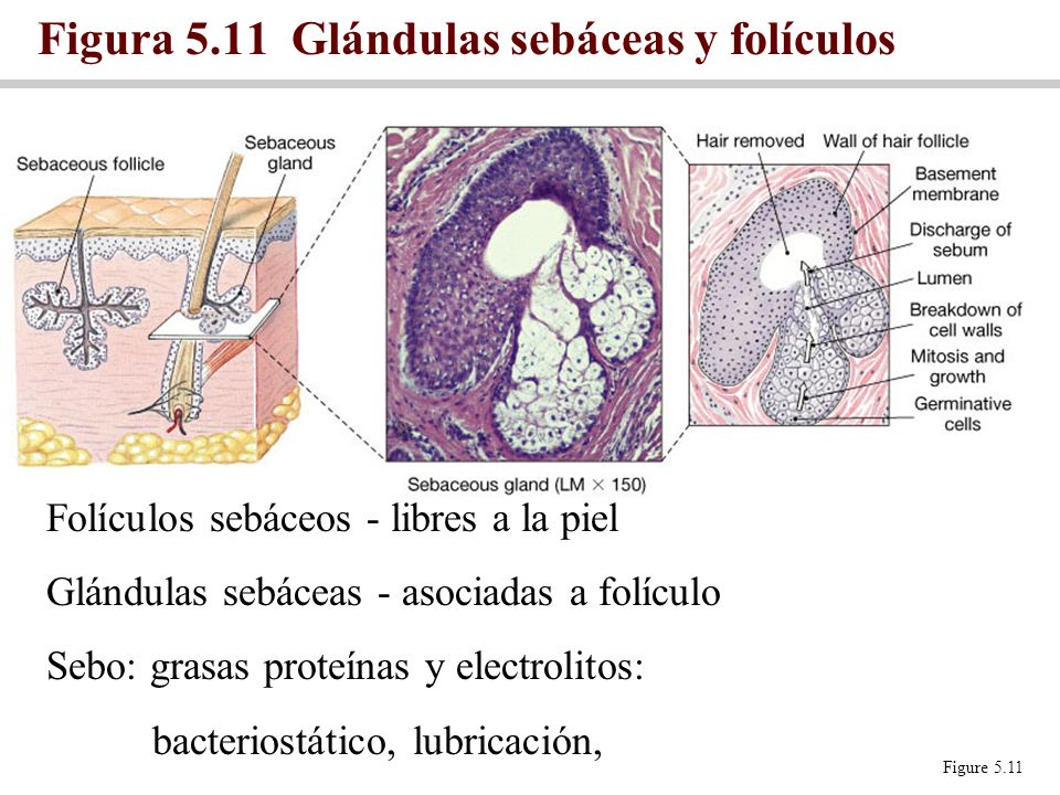 Figura 5.11 Glándulas sebáceas y folículos