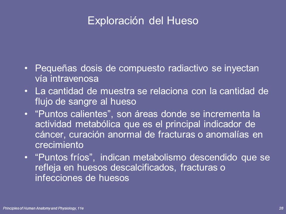 Exploración del Hueso Pequeñas dosis de compuesto radiactivo se inyectan vía intravenosa.