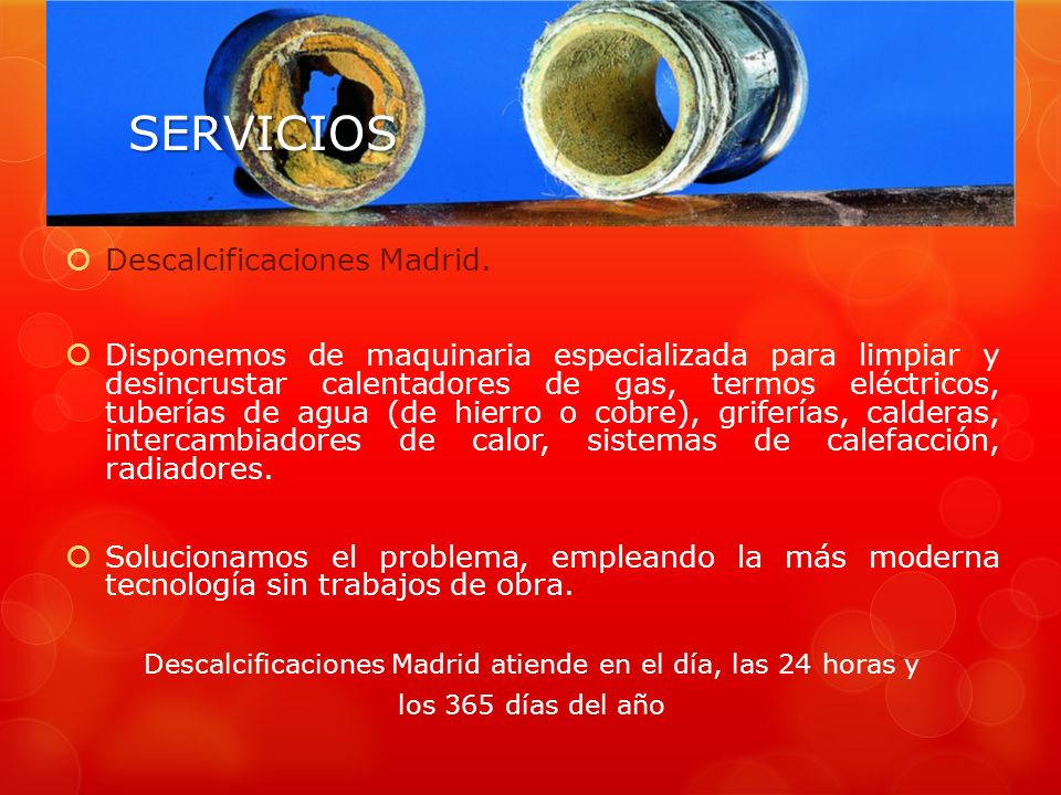 Descalcificaciones Madrid atiende en el día, las 24 horas y