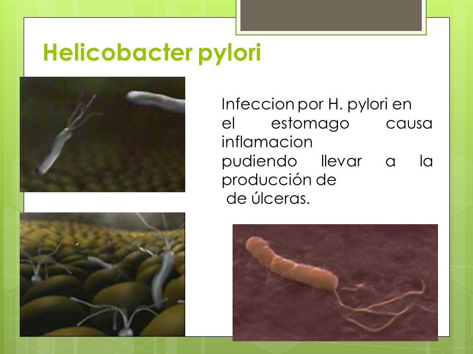 Helicobacter pylori Infeccion por H. pylori en
