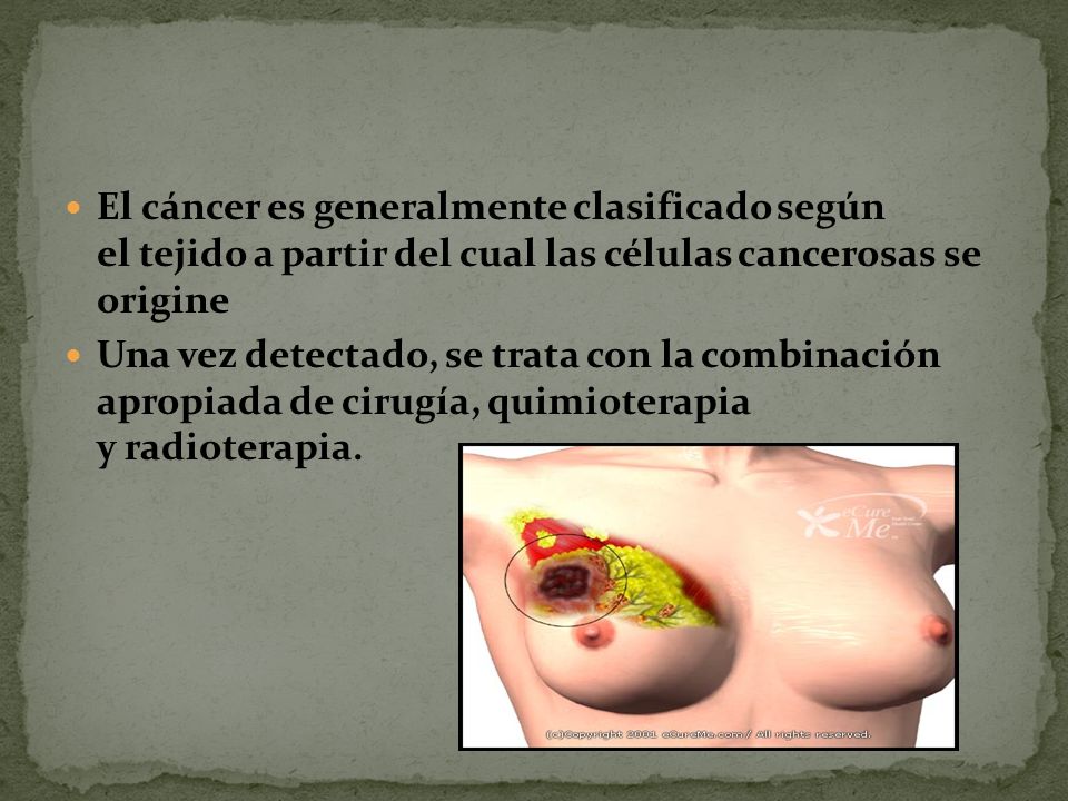 El cáncer es generalmente clasificado según el tejido a partir del cual las células cancerosas se origine