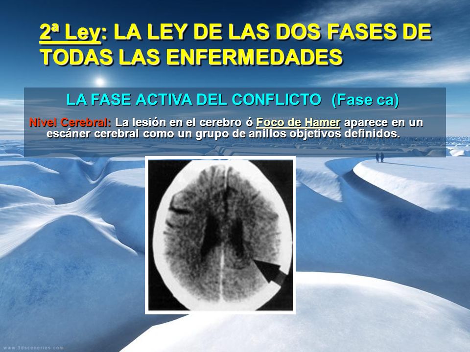 2ª Ley: LA LEY DE LAS DOS FASES DE TODAS LAS ENFERMEDADES