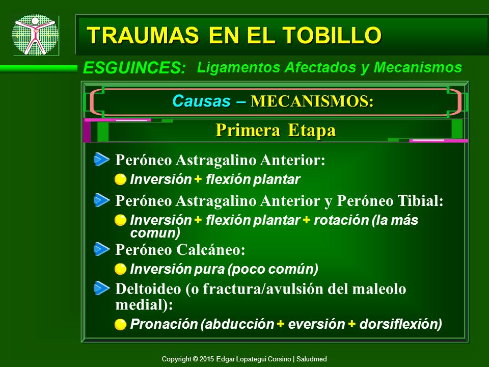 TRAUMAS EN EL TOBILLO Primera Etapa ESGUINCES: Causas – MECANISMOS: