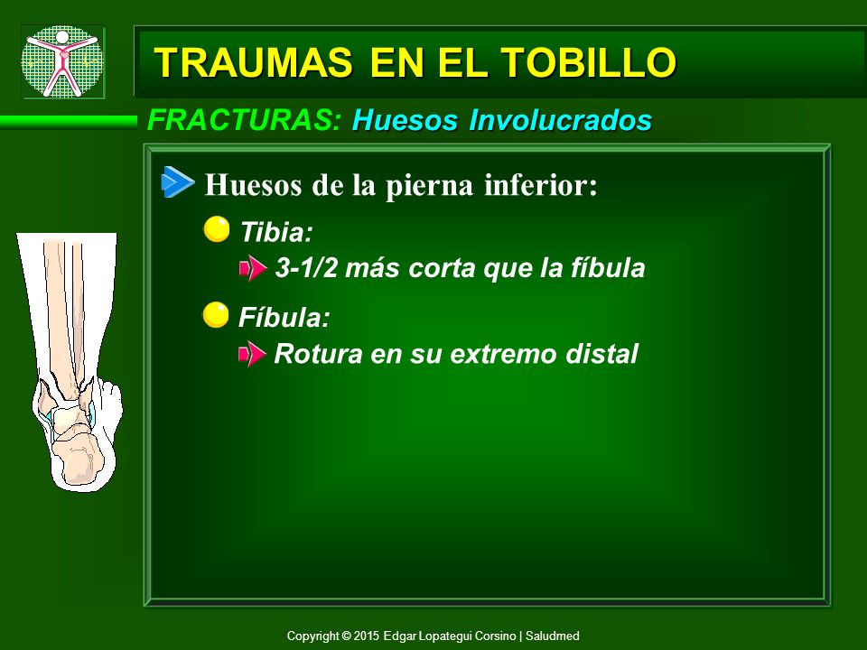 TRAUMAS EN EL TOBILLO Huesos de la pierna inferior: