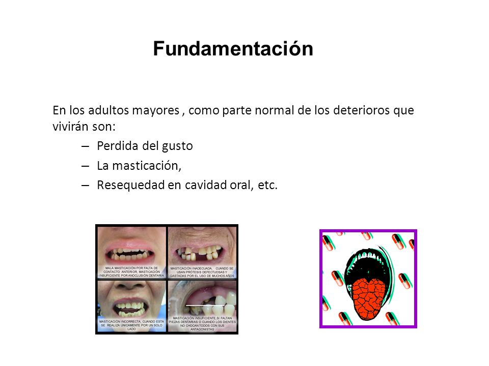 Fundamentación En los adultos mayores , como parte normal de los deterioros que vivirán son: Perdida del gusto.
