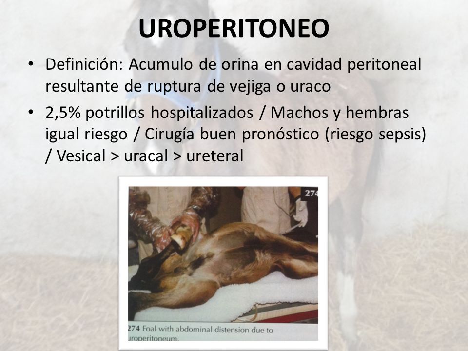 UROPERITONEO Definición: Acumulo de orina en cavidad peritoneal resultante de ruptura de vejiga o uraco.