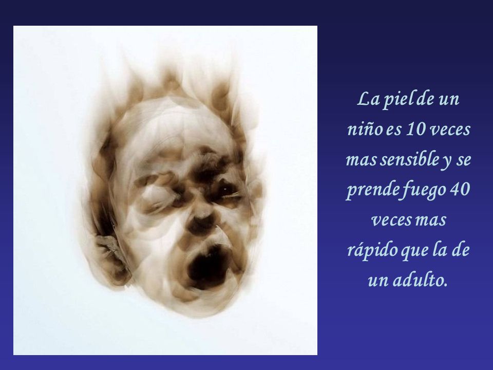 La piel de un niño es 10 veces mas sensible y se prende fuego 40 veces mas rápido que la de un adulto.