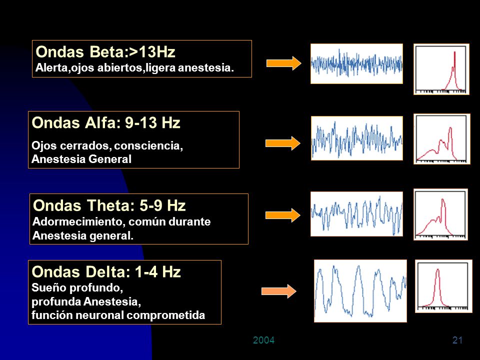 Ondas Beta:>13Hz Ondas Alfa: 9-13 Hz Ondas Theta: 5-9 Hz