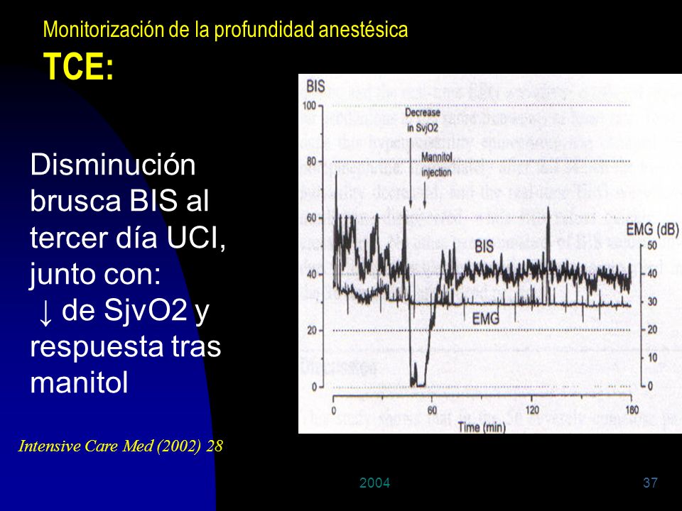 TCE: Disminución brusca BIS al tercer día UCI, junto con: