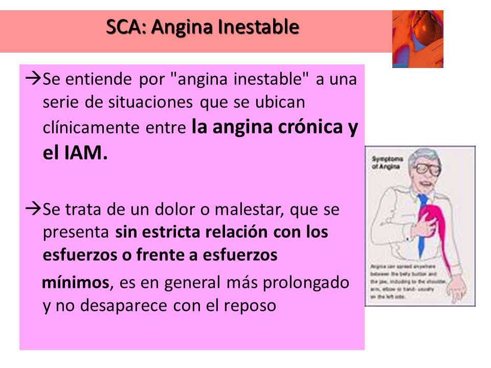 SCA: Angina Inestable Se entiende por angina inestable a una serie de situaciones que se ubican clínicamente entre la angina crónica y el IAM.