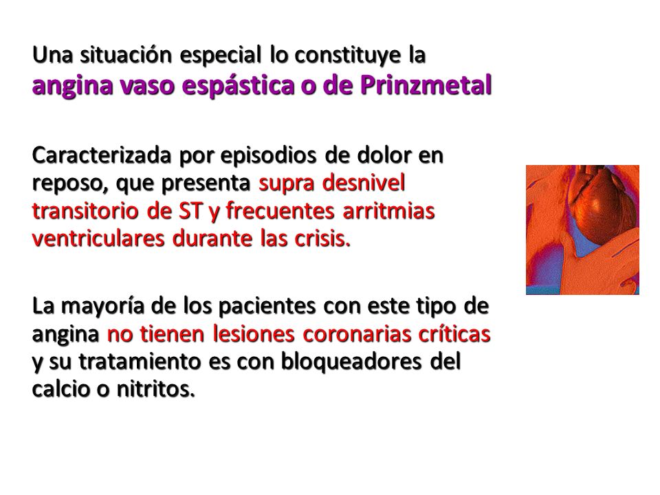 Una situación especial lo constituye la angina vaso espástica o de Prinzmetal