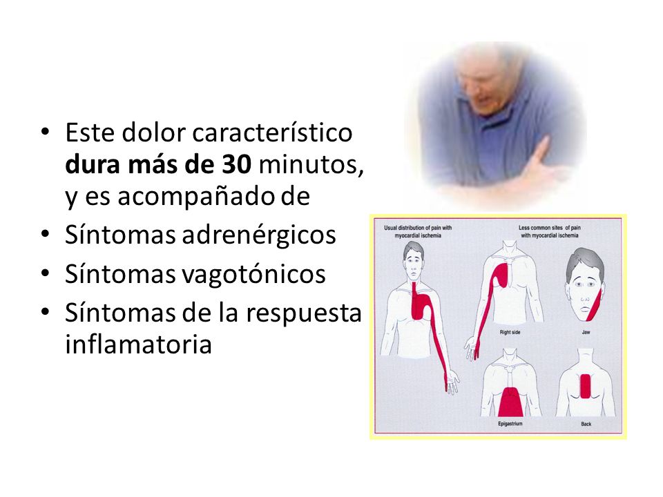 Este dolor característico dura más de 30 minutos, y es acompañado de